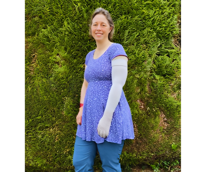 Woman wearing her compression arm sleeve in the summer