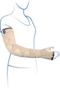 Mobiderm Autofit Armsleeve & Gauntlet
